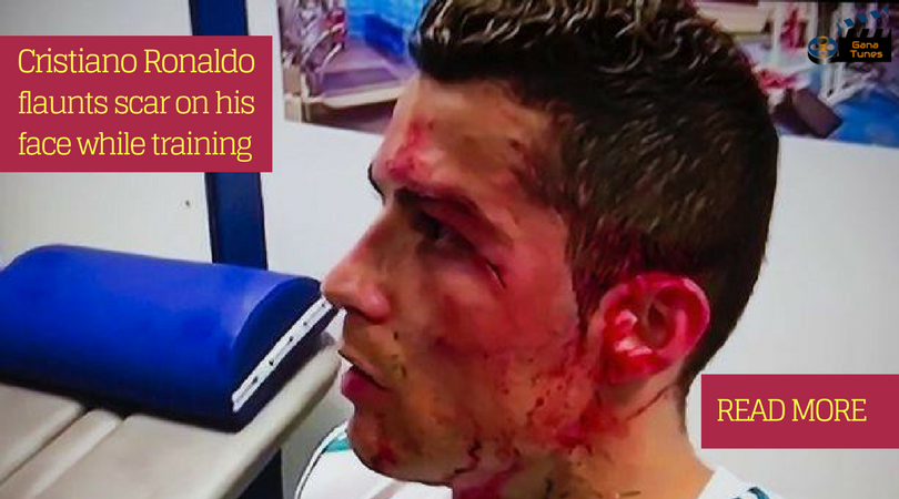 Cristiano Ronaldo flaunts scar